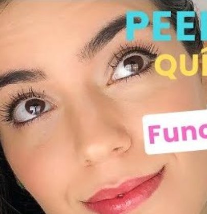 Peeling Químico – Vale a Pena?