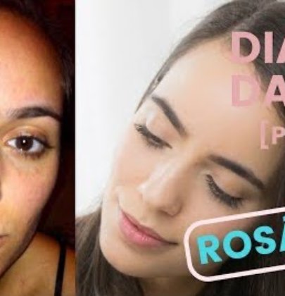 Rosácea – Meu tratamento com Azelan [Diário da Pele – Parte II]