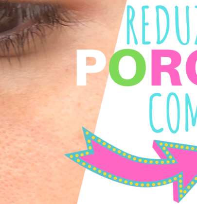 POROS DILATADOS – TEM SOLUÇÃO COM ÁCIDO GLICÓLICO?