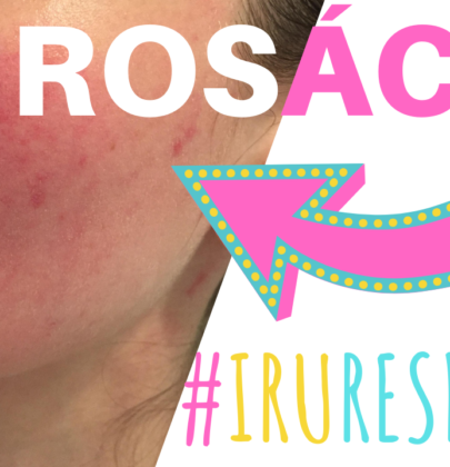 ROSÁCEA #IRURESPONDE